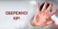 Увага! Обережно - кір! Про профілактичні заходи